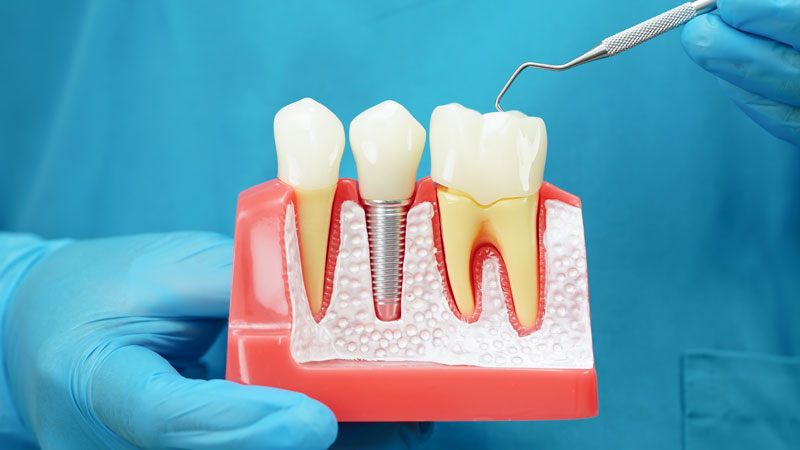 displaying cutaway model of jawline Vaccaeo Aesthetic