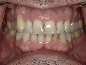  html    head  title 500 Internal Server Error  title   head    body    center  h1 500 Internal Server Error  h1   center    hr  center nginx 1.29.3  center     body     html 