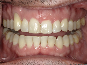  html    head  title 500 Internal Server Error  title   head    body    center  h1 500 Internal Server Error  h1   center    hr  center nginx 1.29.3  center     body     html 