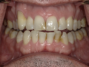  html    head  title 500 Internal Server Error  title   head    body    center  h1 500 Internal Server Error  h1   center    hr  center nginx 1.29.3  center     body     html 