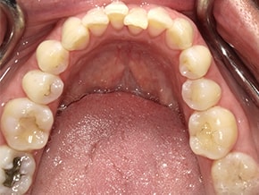  html    head  title 500 Internal Server Error  title   head    body    center  h1 500 Internal Server Error  h1   center    hr  center nginx 1.29.3  center     body     html 