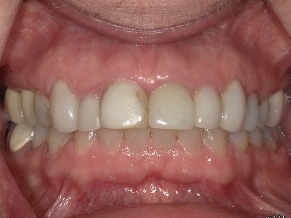 <html>
<head><title>500 Internal Server Error</title></head>
<body>
<center><h1>500 Internal Server Error</h1></center>
<hr><center>nginx/1.29.3</center>
</body>
</html>