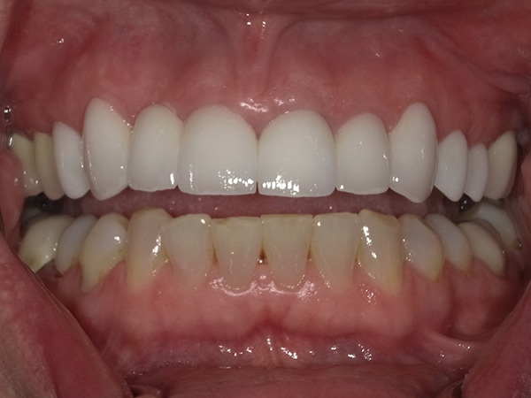 <html>
<head><title>500 Internal Server Error</title></head>
<body>
<center><h1>500 Internal Server Error</h1></center>
<hr><center>nginx/1.29.3</center>
</body>
</html>