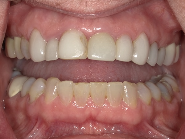  html    head  title 500 Internal Server Error  title   head    body    center  h1 500 Internal Server Error  h1   center    hr  center nginx 1.29.3  center     body     html 