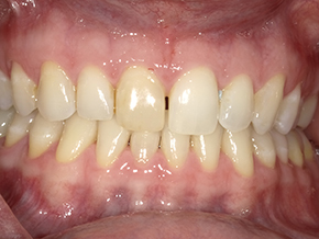 <html>
<head><title>500 Internal Server Error</title></head>
<body>
<center><h1>500 Internal Server Error</h1></center>
<hr><center>nginx/1.29.3</center>
</body>
</html>