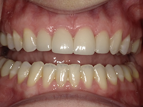 <html>
<head><title>500 Internal Server Error</title></head>
<body>
<center><h1>500 Internal Server Error</h1></center>
<hr><center>nginx/1.29.3</center>
</body>
</html>