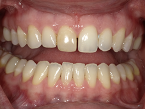 html head title 500 Internal Server Error title head body center h1 500 Internal Server Error h1 center hr center nginx 1.29.3 center body html