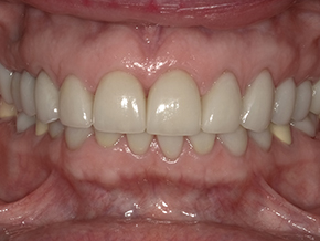 html head title 500 Internal Server Error title head body center h1 500 Internal Server Error h1 center hr center nginx 1.29.3 center body html