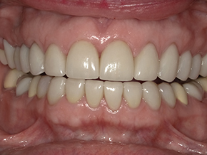 html head title 500 Internal Server Error title head body center h1 500 Internal Server Error h1 center hr center nginx 1.29.3 center body html