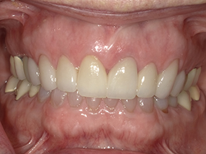 <html>
<head><title>500 Internal Server Error</title></head>
<body>
<center><h1>500 Internal Server Error</h1></center>
<hr><center>nginx/1.29.3</center>
</body>
</html>