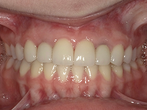 <html>
<head><title>500 Internal Server Error</title></head>
<body>
<center><h1>500 Internal Server Error</h1></center>
<hr><center>nginx/1.29.3</center>
</body>
</html>