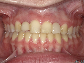 <html>
<head><title>500 Internal Server Error</title></head>
<body>
<center><h1>500 Internal Server Error</h1></center>
<hr><center>nginx/1.29.3</center>
</body>
</html>