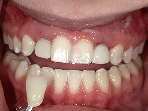  html    head  title 500 Internal Server Error  title   head    body    center  h1 500 Internal Server Error  h1   center    hr  center nginx 1.29.3  center     body     html 