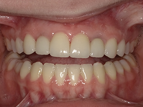  html    head  title 500 Internal Server Error  title   head    body    center  h1 500 Internal Server Error  h1   center    hr  center nginx 1.29.3  center     body     html 