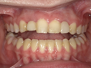  html    head  title 500 Internal Server Error  title   head    body    center  h1 500 Internal Server Error  h1   center    hr  center nginx 1.29.3  center     body     html 