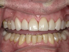  html    head  title 500 Internal Server Error  title   head    body    center  h1 500 Internal Server Error  h1   center    hr  center nginx 1.29.3  center     body     html 