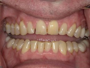  html    head  title 500 Internal Server Error  title   head    body    center  h1 500 Internal Server Error  h1   center    hr  center nginx 1.29.3  center     body     html 