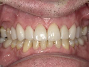 <html>
<head><title>500 Internal Server Error</title></head>
<body>
<center><h1>500 Internal Server Error</h1></center>
<hr><center>nginx/1.29.3</center>
</body>
</html>