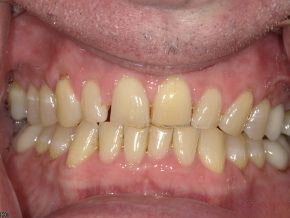 <html>
<head><title>500 Internal Server Error</title></head>
<body>
<center><h1>500 Internal Server Error</h1></center>
<hr><center>nginx/1.29.3</center>
</body>
</html>