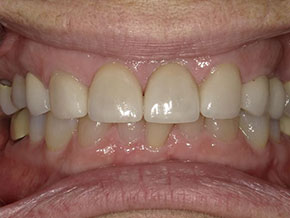 <html>
<head><title>500 Internal Server Error</title></head>
<body>
<center><h1>500 Internal Server Error</h1></center>
<hr><center>nginx/1.29.3</center>
</body>
</html>