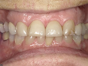  html    head  title 500 Internal Server Error  title   head    body    center  h1 500 Internal Server Error  h1   center    hr  center nginx 1.29.3  center     body     html 