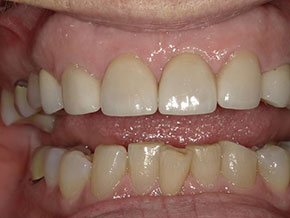  html    head  title 500 Internal Server Error  title   head    body    center  h1 500 Internal Server Error  h1   center    hr  center nginx 1.29.3  center     body     html 