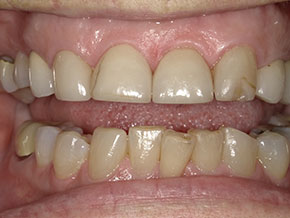  html    head  title 500 Internal Server Error  title   head    body    center  h1 500 Internal Server Error  h1   center    hr  center nginx 1.29.3  center     body     html 