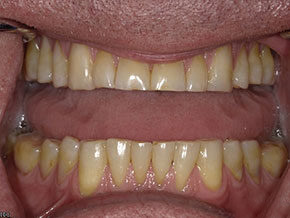  html    head  title 500 Internal Server Error  title   head    body    center  h1 500 Internal Server Error  h1   center    hr  center nginx 1.29.3  center     body     html 