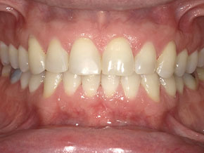 <html>
<head><title>500 Internal Server Error</title></head>
<body>
<center><h1>500 Internal Server Error</h1></center>
<hr><center>nginx/1.29.3</center>
</body>
</html>