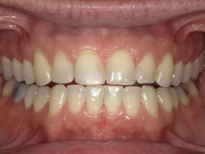  html    head  title 500 Internal Server Error  title   head    body    center  h1 500 Internal Server Error  h1   center    hr  center nginx 1.29.3  center     body     html 