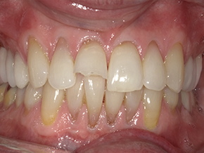 <html>
<head><title>500 Internal Server Error</title></head>
<body>
<center><h1>500 Internal Server Error</h1></center>
<hr><center>nginx/1.29.3</center>
</body>
</html>