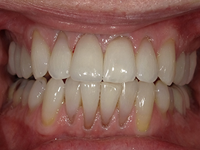 <html>
<head><title>500 Internal Server Error</title></head>
<body>
<center><h1>500 Internal Server Error</h1></center>
<hr><center>nginx/1.29.3</center>
</body>
</html>