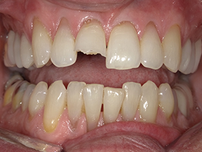  html    head  title 500 Internal Server Error  title   head    body    center  h1 500 Internal Server Error  h1   center    hr  center nginx 1.29.3  center     body     html 