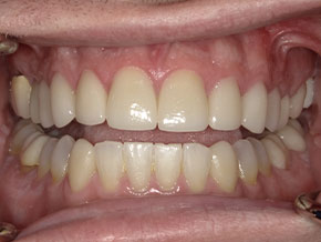  html    head  title 500 Internal Server Error  title   head    body    center  h1 500 Internal Server Error  h1   center    hr  center nginx 1.29.3  center     body     html 