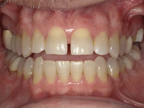  html    head  title 500 Internal Server Error  title   head    body    center  h1 500 Internal Server Error  h1   center    hr  center nginx 1.29.3  center     body     html 