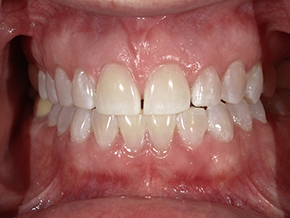 <html>
<head><title>500 Internal Server Error</title></head>
<body>
<center><h1>500 Internal Server Error</h1></center>
<hr><center>nginx/1.29.3</center>
</body>
</html>