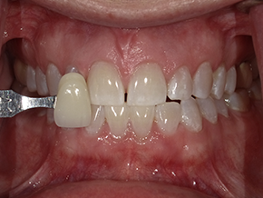  html    head  title 500 Internal Server Error  title   head    body    center  h1 500 Internal Server Error  h1   center    hr  center nginx 1.29.3  center     body     html 