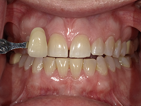  html    head  title 500 Internal Server Error  title   head    body    center  h1 500 Internal Server Error  h1   center    hr  center nginx 1.29.3  center     body     html 