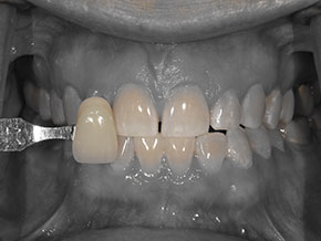  html    head  title 500 Internal Server Error  title   head    body    center  h1 500 Internal Server Error  h1   center    hr  center nginx 1.29.3  center     body     html 