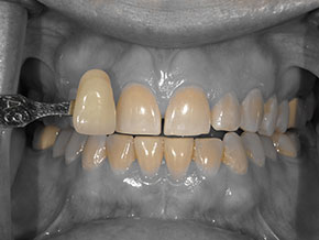  html    head  title 500 Internal Server Error  title   head    body    center  h1 500 Internal Server Error  h1   center    hr  center nginx 1.29.3  center     body     html 