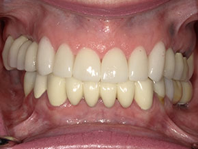  html    head  title 500 Internal Server Error  title   head    body    center  h1 500 Internal Server Error  h1   center    hr  center nginx 1.29.3  center     body     html 