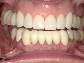  html    head  title 500 Internal Server Error  title   head    body    center  h1 500 Internal Server Error  h1   center    hr  center nginx 1.29.3  center     body     html 