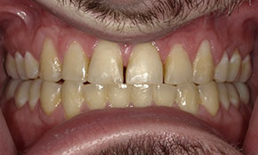 <html>
<head><title>500 Internal Server Error</title></head>
<body>
<center><h1>500 Internal Server Error</h1></center>
<hr><center>nginx/1.29.3</center>
</body>
</html>