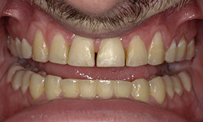 <html>
<head><title>500 Internal Server Error</title></head>
<body>
<center><h1>500 Internal Server Error</h1></center>
<hr><center>nginx/1.29.3</center>
</body>
</html>