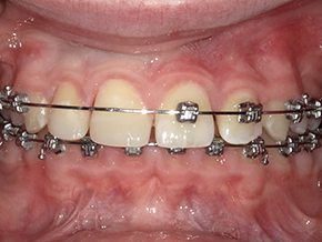 <html>
<head><title>500 Internal Server Error</title></head>
<body>
<center><h1>500 Internal Server Error</h1></center>
<hr><center>nginx/1.29.3</center>
</body>
</html>