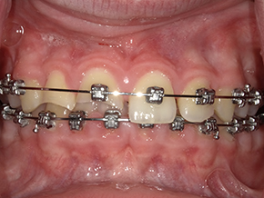 <html>
<head><title>500 Internal Server Error</title></head>
<body>
<center><h1>500 Internal Server Error</h1></center>
<hr><center>nginx/1.29.3</center>
</body>
</html>