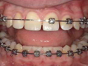 <html>
<head><title>500 Internal Server Error</title></head>
<body>
<center><h1>500 Internal Server Error</h1></center>
<hr><center>nginx/1.29.3</center>
</body>
</html>