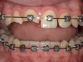  html    head  title 500 Internal Server Error  title   head    body    center  h1 500 Internal Server Error  h1   center    hr  center nginx 1.29.3  center     body     html 