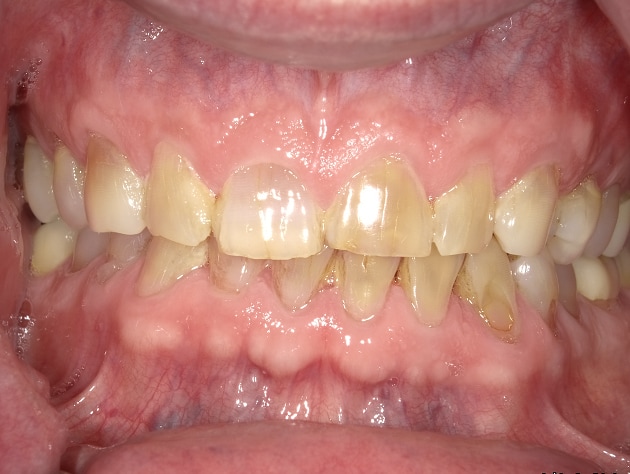 <html>
<head><title>500 Internal Server Error</title></head>
<body>
<center><h1>500 Internal Server Error</h1></center>
<hr><center>nginx/1.29.3</center>
</body>
</html>