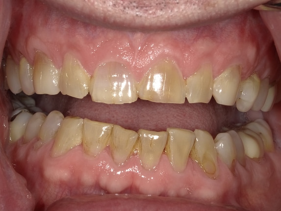  html    head  title 500 Internal Server Error  title   head    body    center  h1 500 Internal Server Error  h1   center    hr  center nginx 1.29.3  center     body     html 